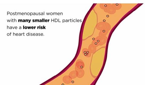 Chez les femmes ménopausées, une concentration plus élevée de particules de HDL est associée à un risque plus faible d'athérosclérose 