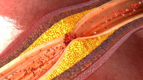 Un simple remodelage du microbiome intestinal peut entraîner des effets artériels considérables (Visuel Adobe Stock_113512803)