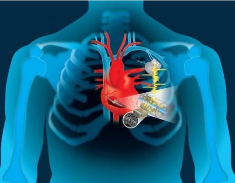 Exploiter la puissance du rythme cardiaque pour recharger son stimulateur ou « les batteries du coeur »