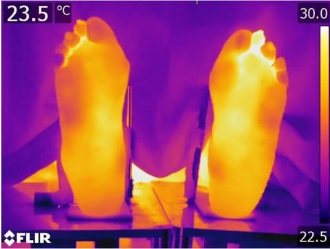 Image thermique montrant les températures dans les différentes régions du pied (Visuel Staffordshire University)