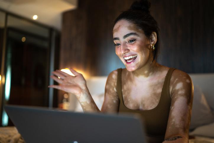une femme avec un vitiligo discute sur internet