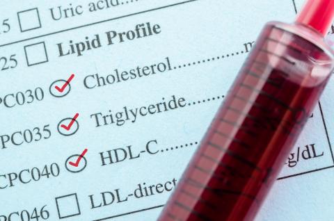 Le « bon » cholestérol HDL (High Density Lipoprotein) peut prévenir l'inflammation du foie (Vkisuel Adobe Stock 111046439)