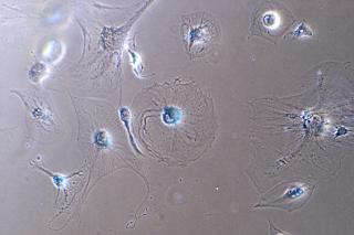 Cette photo au microscope montre des cellules myoblastes sénescentes. 