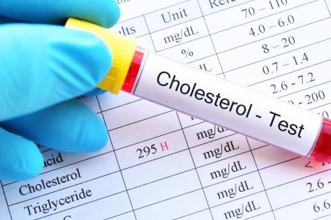 La plupart des patients atteints d'hypercholestérolémie familiale ne sont toujours pas diagnostiqués (Visuel Fotolia)