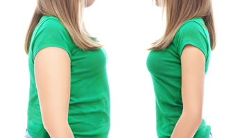 Le sémaglutide aide à la perte de poids chez l'adolescent obèse