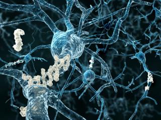 Plaques d'amyloid fixées sur des réseaux neuronaux 